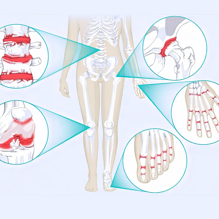 Common arthritis in human body