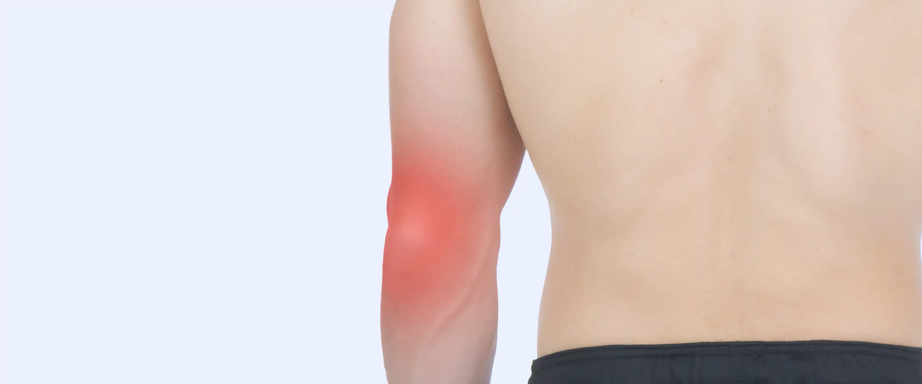 Hyperextended Elbow Pain