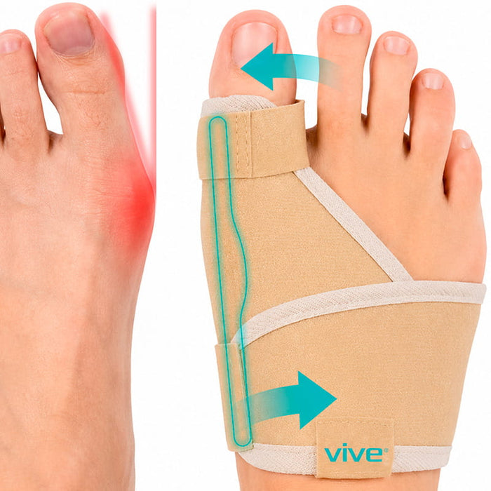 Bunion Splint