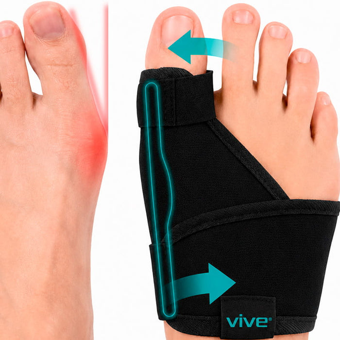 Bunion Splint