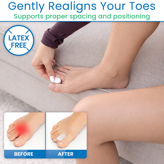 Gently Realigns Your Toes