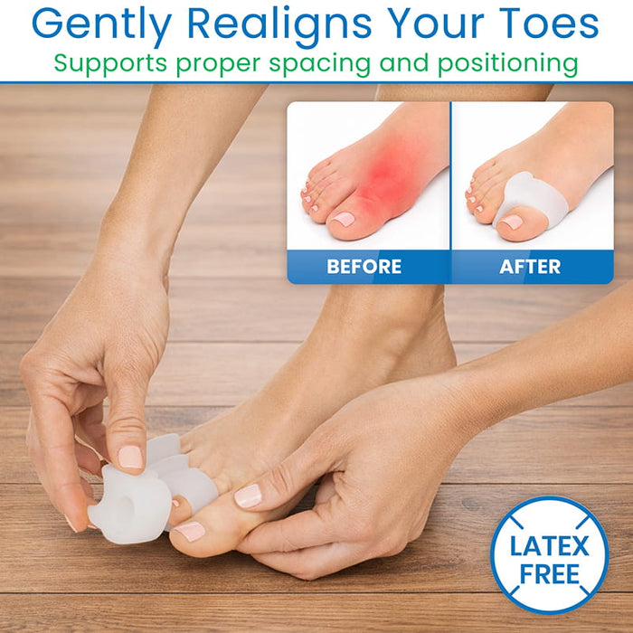 Gently Realigns Your Toes