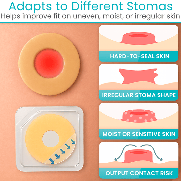 Adapts to Different Stomas