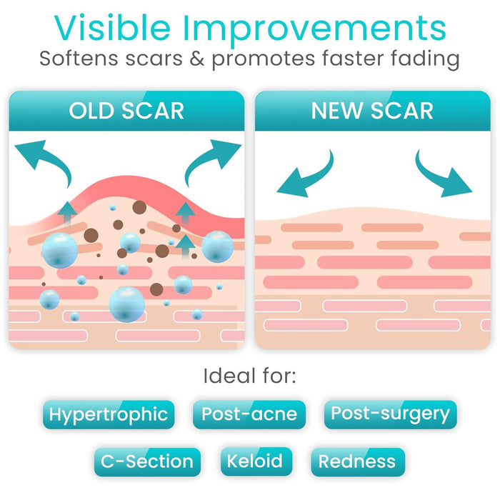 Soften scars and promotes faster fading