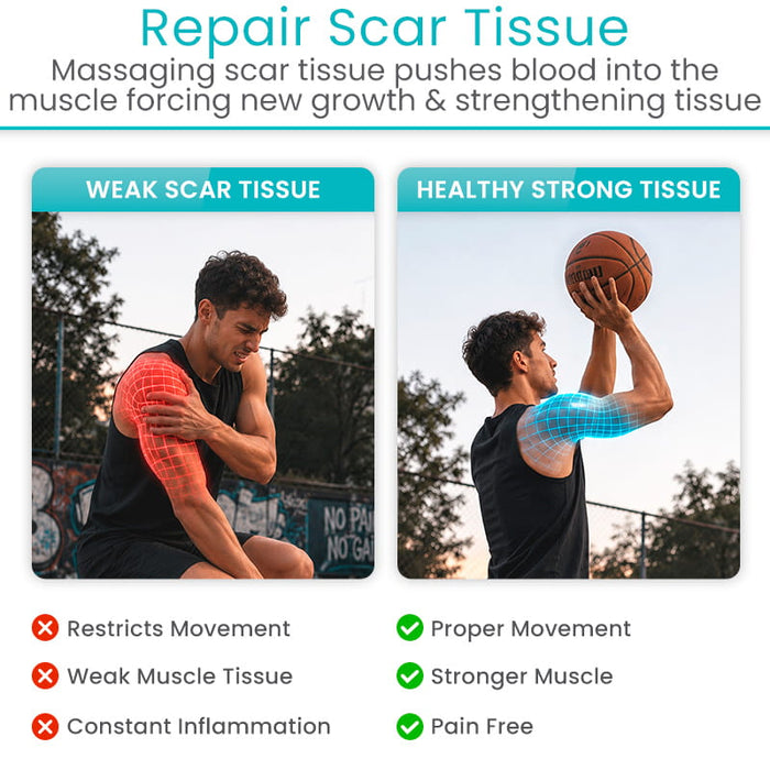 Repair Scar Tissue