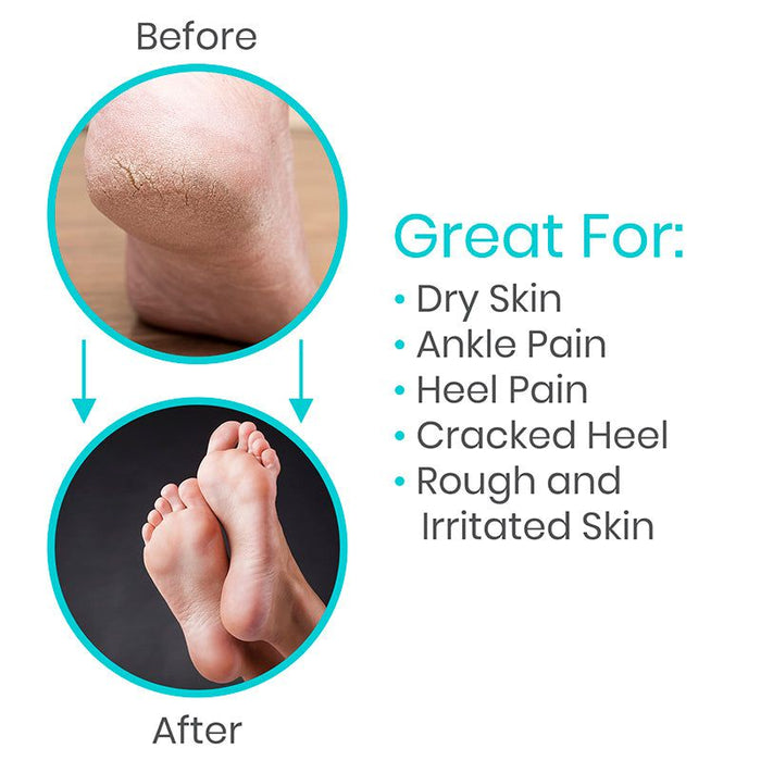 Moisturizing Socks for dry skin, heel pain, cracked heels, rough & irritated skin, and ankle pain