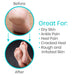 Moisturizing Socks for dry skin, heel pain, cracked heels, rough & irritated skin, and ankle pain